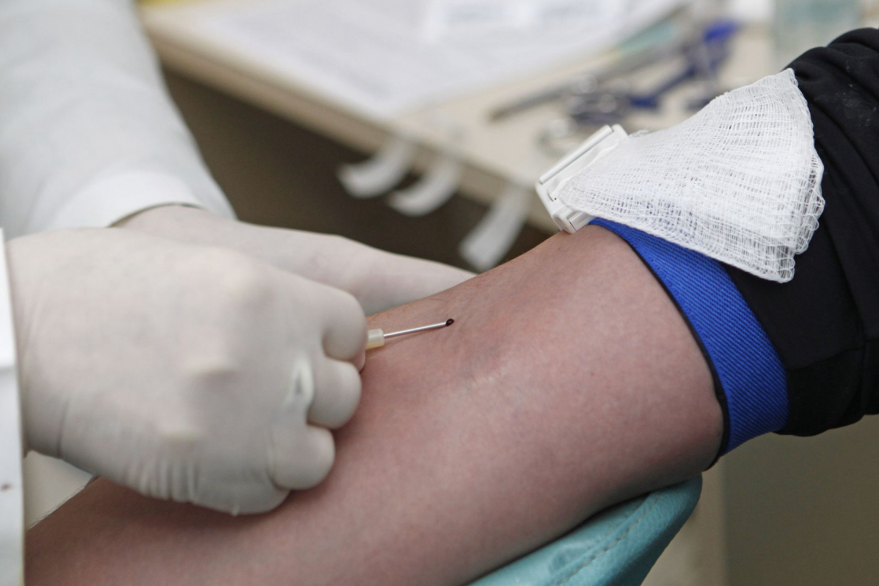 Sorologia para HIV, sífilis e hepatite são alguns dos exames universais. Foto: Antônio More/Gazeta do Povo. 